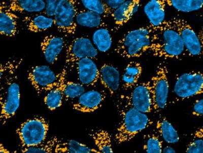 Immunocytochemistry/Immunofluorescence: Goat anti-Human IgG Fc Secondary Antibody [DyLight 550] [NBP1-75816] - MCF7 human breast cancer cell line. Image from verified customer review.